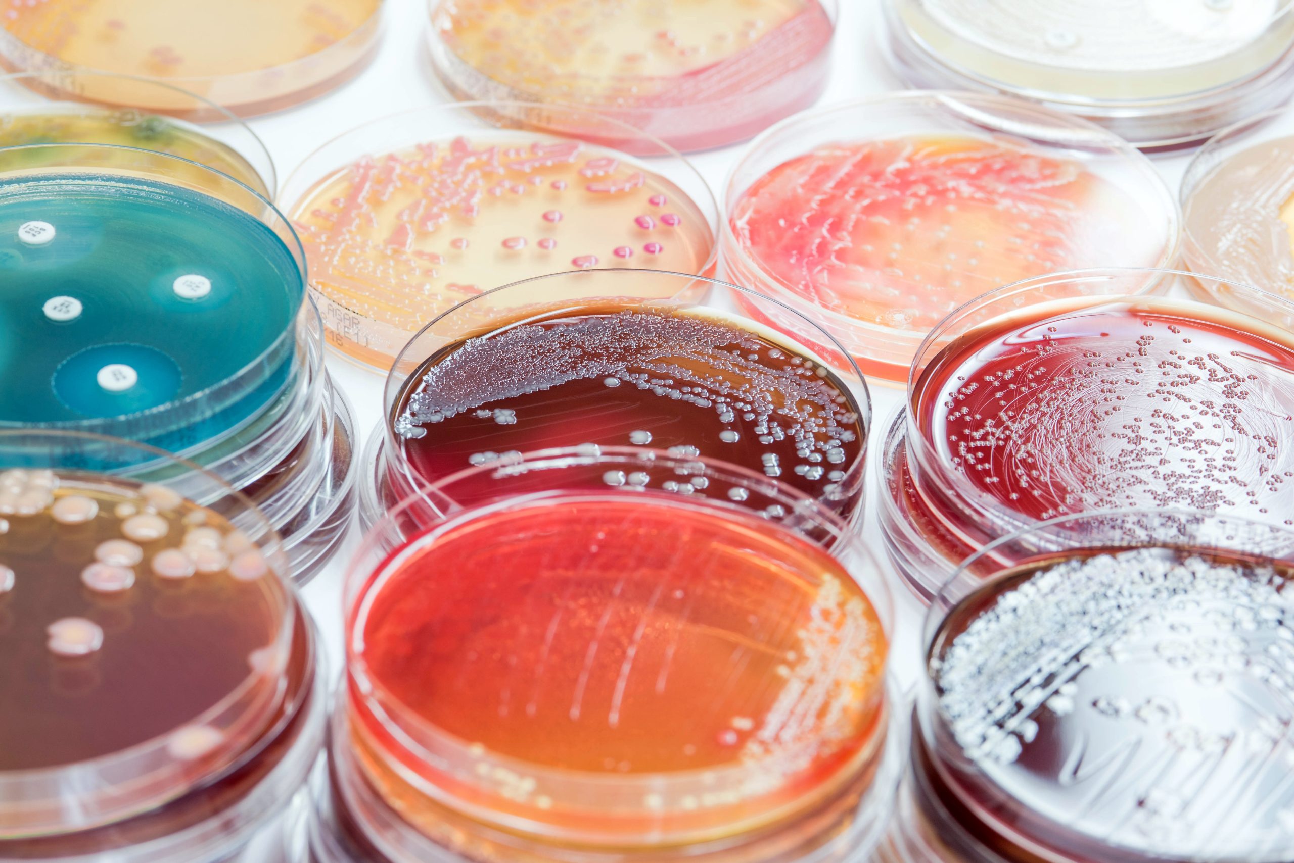 petri dishes